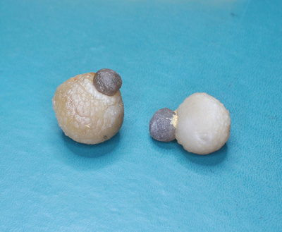 Kaksi kalsiitti - kalsiitti pallo palloa 153.80 ct Marokko