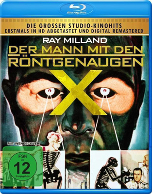 Röntgen katse mies