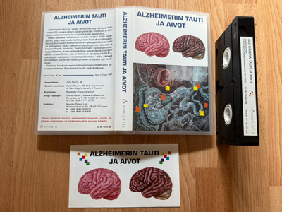 Alzheimerin tauti ja aivot. 