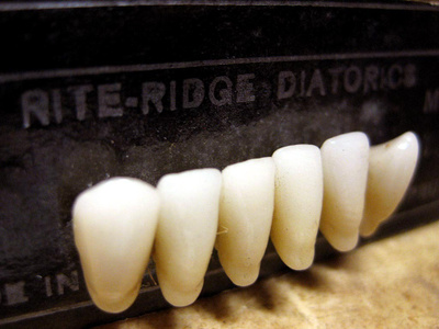 Entisajan hammasproteesit, Belform Teeth