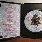 ALICE COOPER:WELCOME TO MY NIGHTMARE DVD - pikkukuva 3
