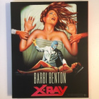 Schizoid / X-Ray (2x 4K Ultra HD + Blu-ray (Vinegar S) - pikkukuva 2