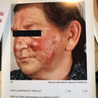 Lääketieteellinen kuvasalkku (ei herkille) - pikkukuva 4