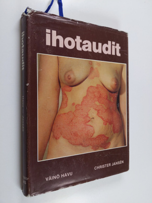 Väinö K. Havu : Ihotaudit