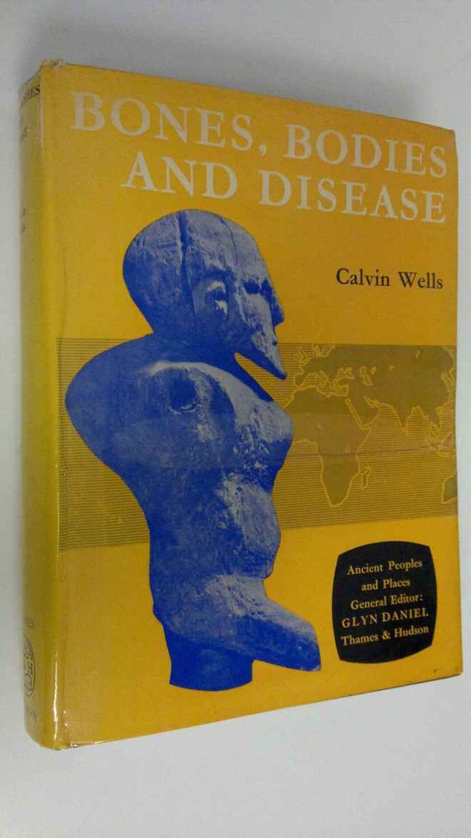 Calvin Wells : Bones, bodies and disease : Evidence of de...