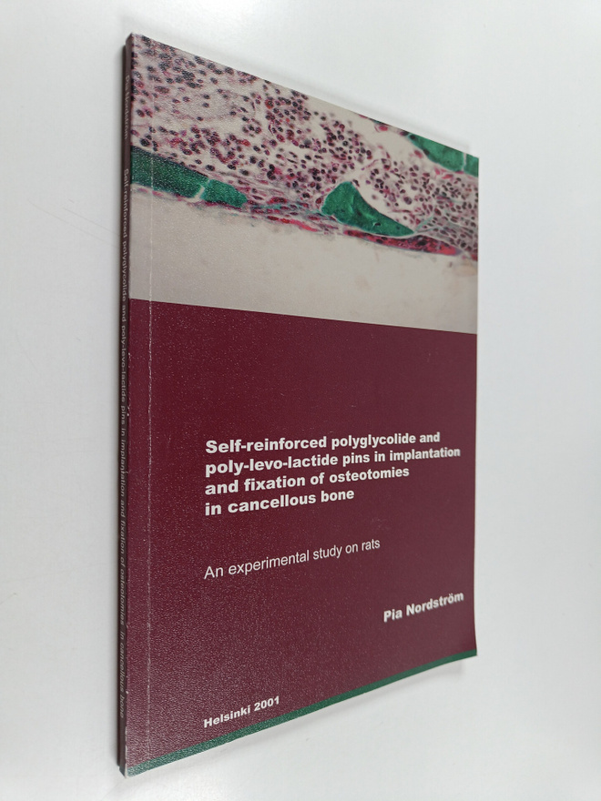 Pia Nordström : Self-reinforced polyglycolide and poly-le...