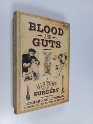 Richard Hollingham : Blood and guts : a history of surgery