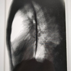 Kyösti Lehtomäki : Rapid Etiological Diagnosis of Pneumon... - pikkukuva 2