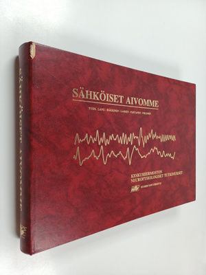 Sähköiset aivomme
