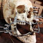 Kirurginen suunlevitin (Molt Mouth Gag), Eurooppa - pikkukuva 2