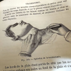 Kirurgian käsikirja – Éléments de médecine opératoire, A. Du - pikkukuva 3