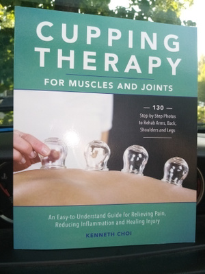 CHOI :  CUPPING THERAPY ( SIS POSTIKULU)