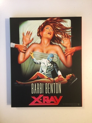 X-Ray / Schizoid (2x 4K Ultra HD + Blu-ray (Vinegar S) UUSI