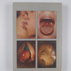 T. R. Bull : A Colour Atlas of E.N.T. Diagnosis - pikkukuva 2