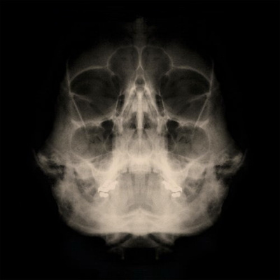 MyChildren MyBride: Unbreakable (CD)