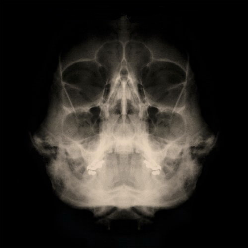 MyChildren MyBride: Unbreakable (CD)