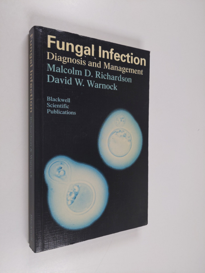 Malcolm D. Richardson : Fungal infection : diagnosis and ...