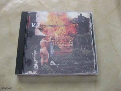 V-3-Photograph Burns