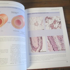 An Atlas Of Chronic Obstructive Pulmonary Disease - pikkukuva 3