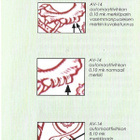 M-75 L 0,10 lila Type II B xX AV 14 ** LaPe 823 B II a) vas - pikkukuva 3