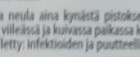 ThinPen kynäneula 8mm/ 31g - pikkukuva 2