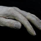 Fortitude –sarjan ”Male Victims arm” - pikkukuva 3
