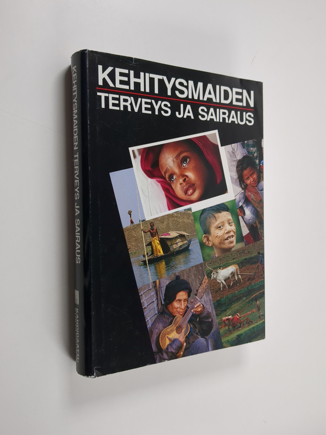 Kehitysmaiden terveys ja sairaus