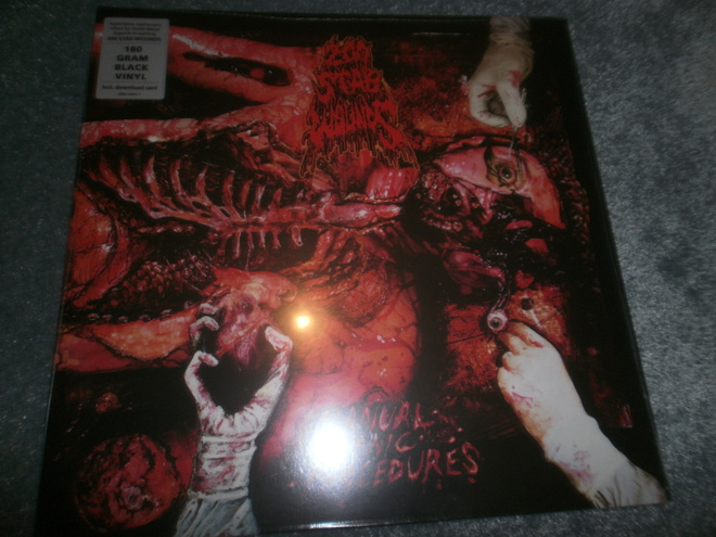 200 Stab Wounds – Manual Manic Procedures Lp