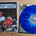Dying Fetus: War on  Attrition - pikkukuva 2