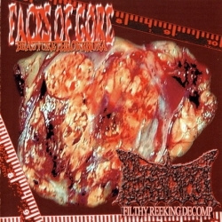 Faces Of Gore|Biocyst - Bradyurethrorrhoea / Filthy Reeking