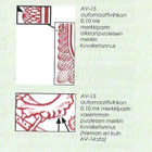 M-75 L 0,10 lila Type II B xX AV 15 ** LaPe 823 B II c) oik - pikkukuva 3