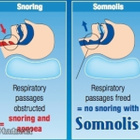 Somnolis® laadukas sveitsiläinen kuorsauskisko - pikkukuva 4