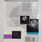 Rafael C. Conzalez : Digital image processing - pikkukuva 2