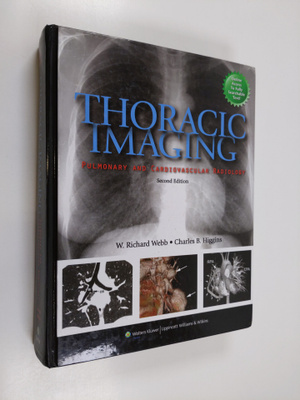 W. Richard Webb ym. : Thoracic Imaging - Pulmonary and Ca...