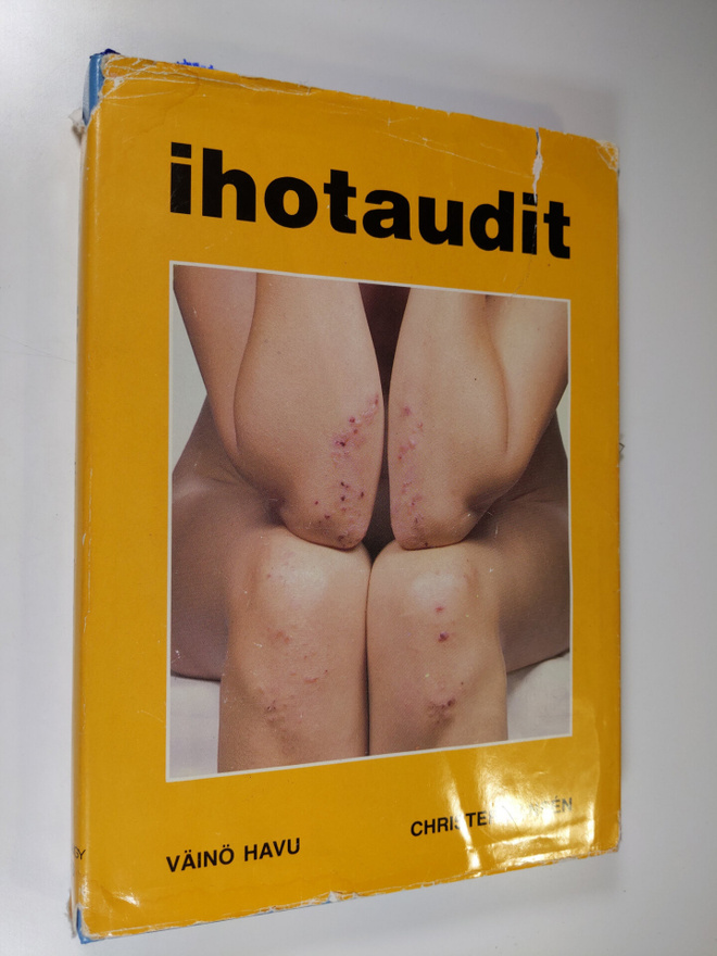 Väinö K. Havu : Ihotaudit