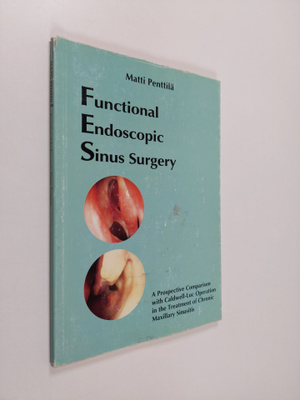Matti Penttilä : Functional Endoscopic Sinus Surgery - A ...