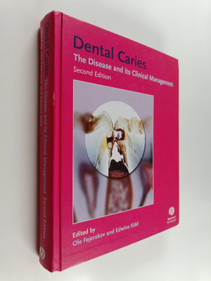 Dental caries : the disease and its clinical management