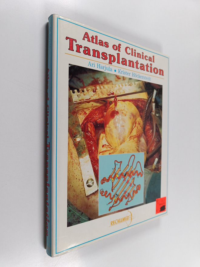 Ari Harjula : Atlas of clinical transplantation