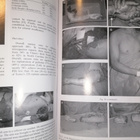 Hand Clinics Mutilating Hand Injuries - pikkukuva 3