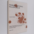Tuomo Timonen : Human Natural Killer Cells - Isolation, M... - pikkukuva 1