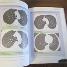 An Atlas Of Chronic Obstructive Pulmonary Disease - pikkukuva 4
