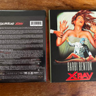 Schizoid / X-Ray 4K UHD (Vinegar Syndrome) - pikkukuva 2