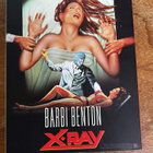 Schizoid / X-Ray 4K UHD (Vinegar Syndrome) - pikkukuva 3