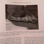 Hand Clinics Mutilating Hand Injuries - pikkukuva 4