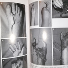Hand Clinics Mutilating Hand Injuries - pikkukuva 2