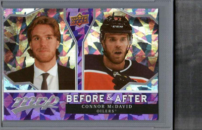 2021-22 Upper Deck MVP - Before and After - 0,50 € / kpl