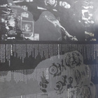 Motörhead - No Remorse - pikkukuva 4