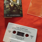 Stone- no anaesthesia - pikkukuva 1