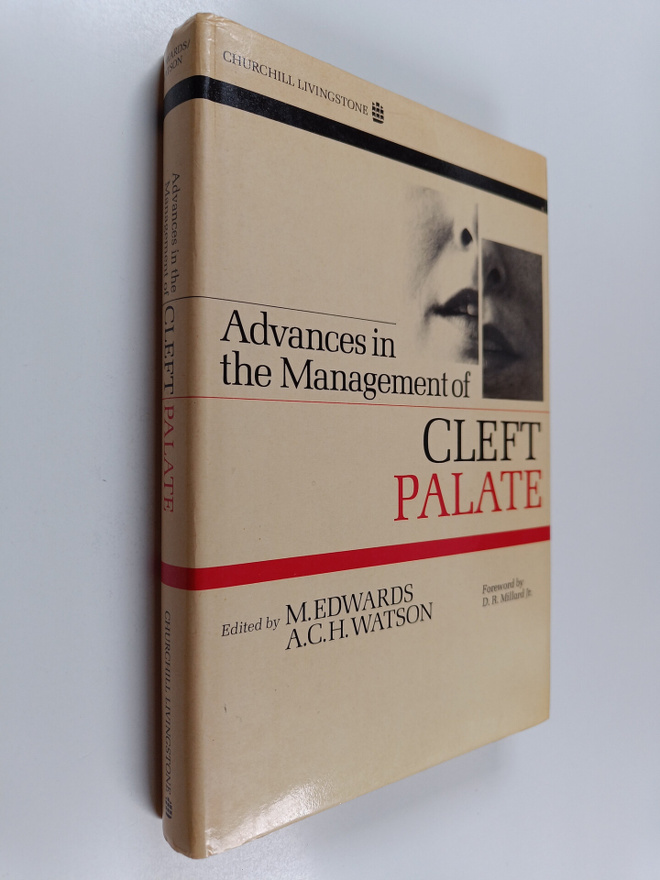 Advances in the management of cleft palate