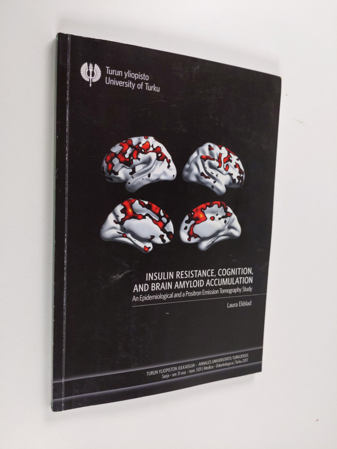 Laura Ekblad : Insulin resistance, cognition, and brain a...